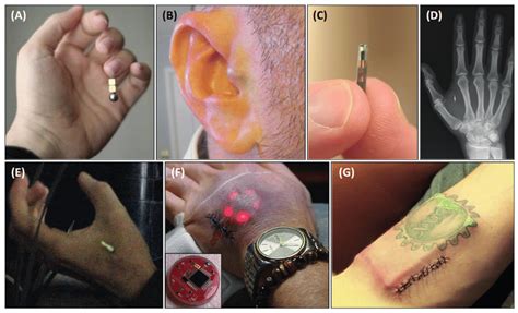 subcutaneous rfid tags|rfid implant benefits.